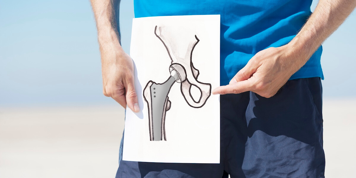 Post Surgery / Joint Replacement Rehabilitation service photo